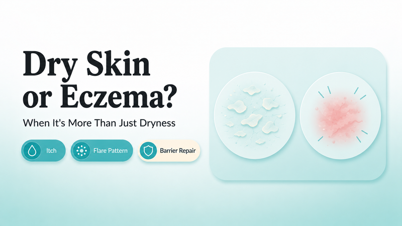 Dry Skin or Eczema? When It's More Than Just Dryness